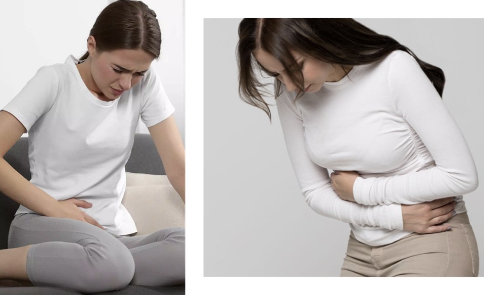 과민대장증후군 치료