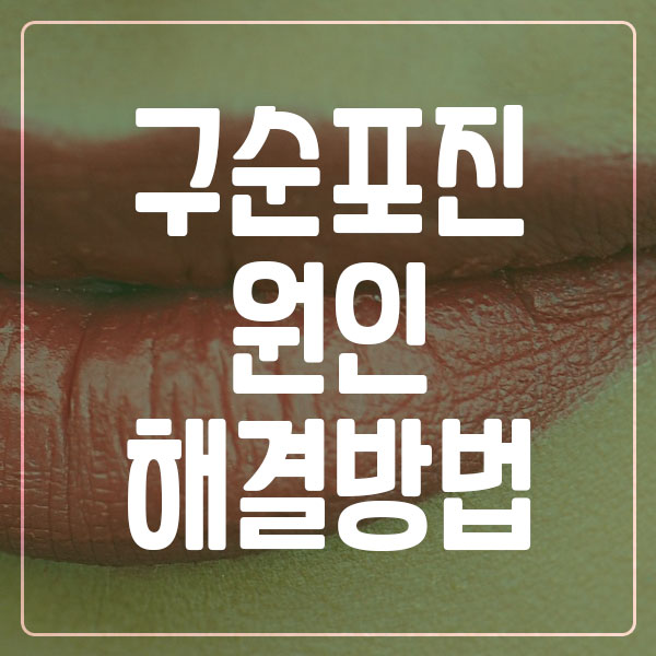 구순포진 원인 및 해결방법