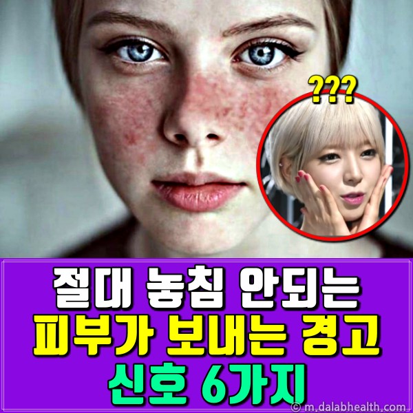 피부 아토피 원인,생로병사의비밀