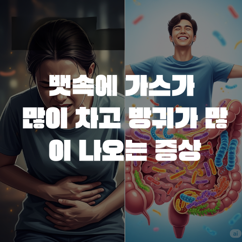 뱃속에 가스많이 차고 방귀가 많아지는 증상