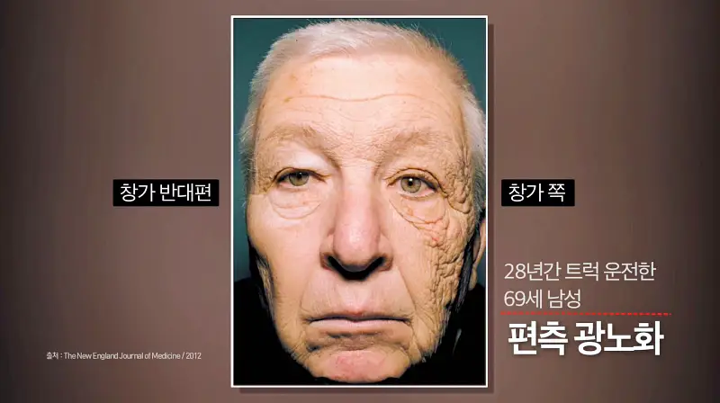 KBS 생로병사의 비밀 824회 피부 건강 치명적 몸에 쌓이는 독 자외선 차단의 모든 것