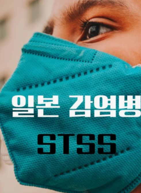 일본전염병