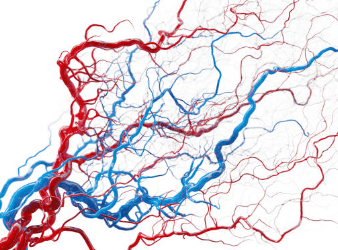 하지 정맥류 증상 수술비용