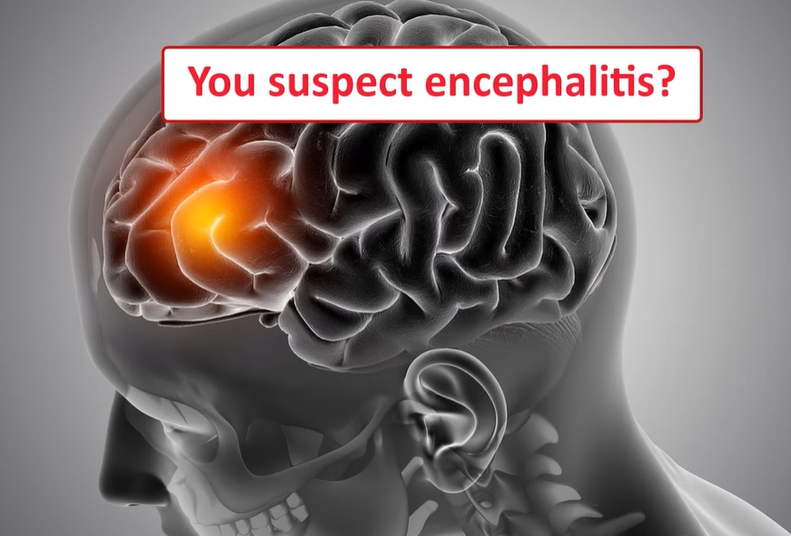 아시클로버 연고 효능