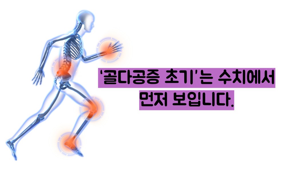 골다공증 수치