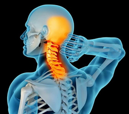 뒷 목 경추에 통증이 있는 이미지