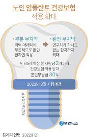 임플란트 가격
