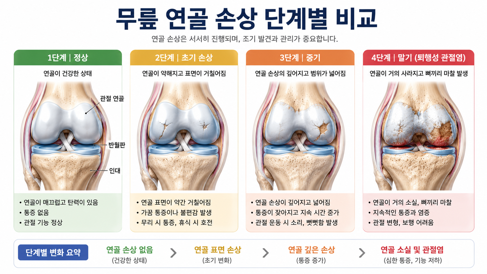 계단 내려갈 때 무릎이 시큰거린다면,연골 신호일 수 있습니다