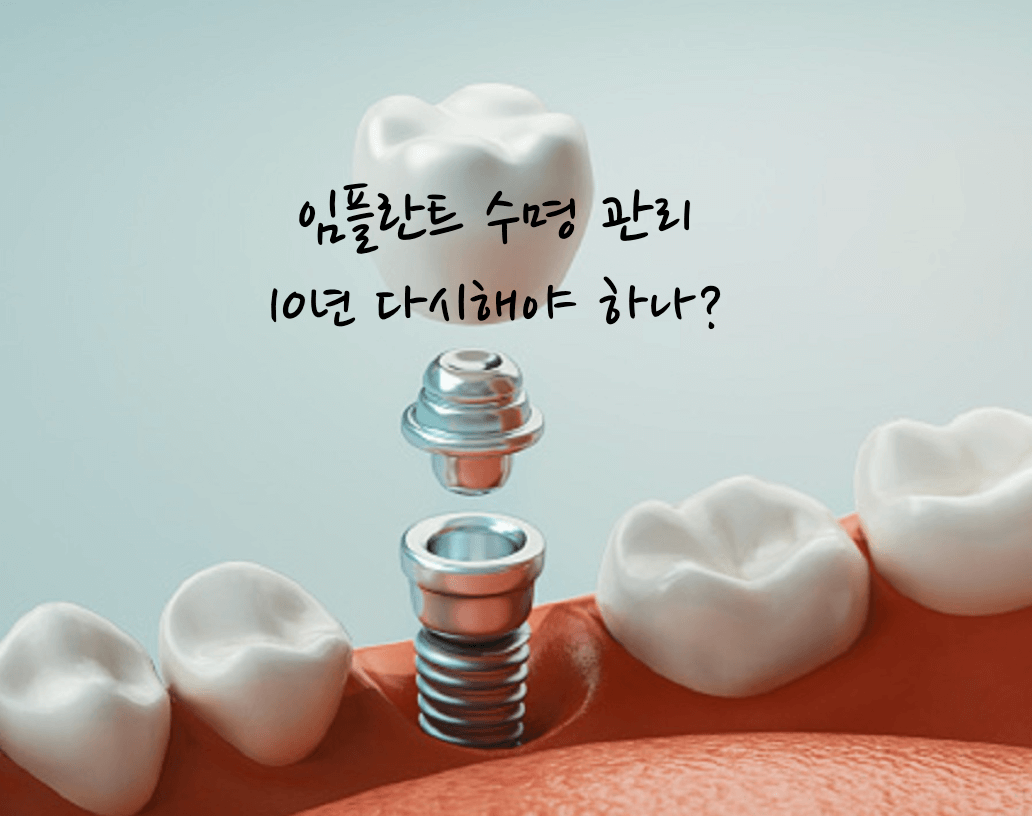 임플란트 수명