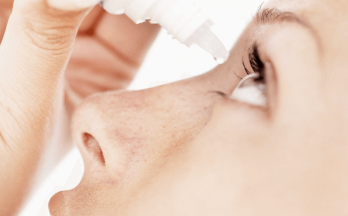 안구건조증 치료와 예방법