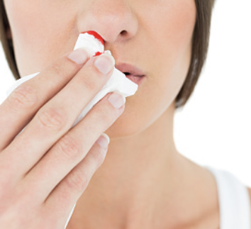 코피가 자주나는 이유 25