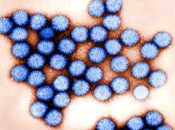 노로-바이러스를-확대해서-찍은-사진으로-여러-개의-바이러스가-모여있다.