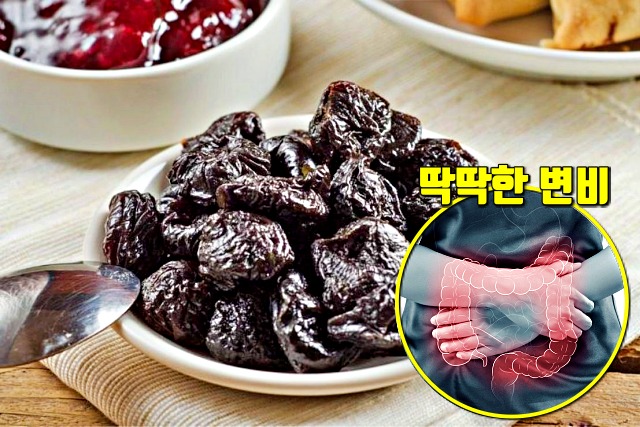 푸룬 효능, 변비 직빵, 변비에 좋은 음식 변비해결방법, 건강 팁줌 매일꿀정보