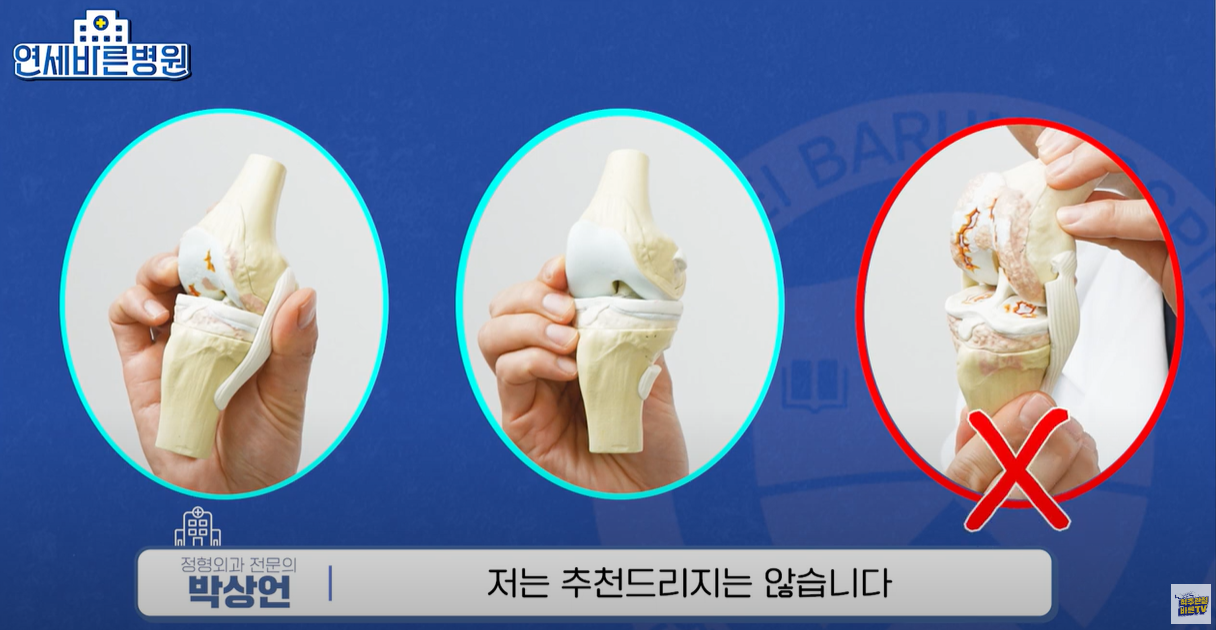 많이 망가진 연골에는 적합하지 않는 치료방법