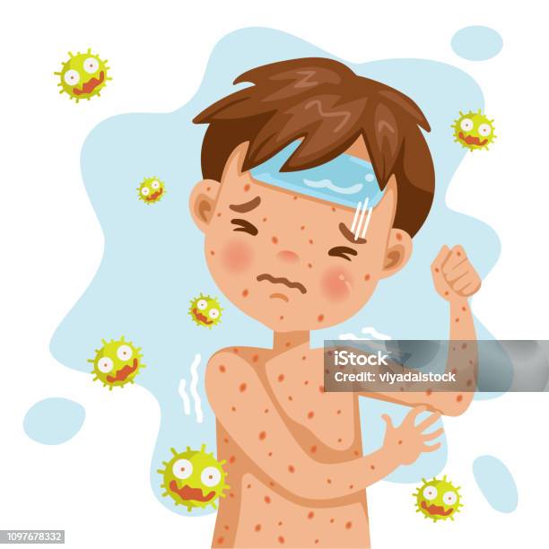 수두 관련 사진