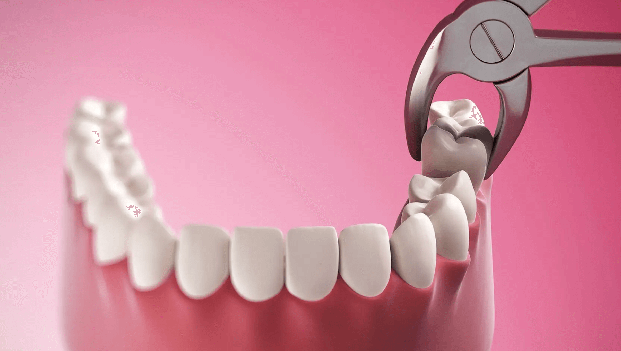 어금니 염증 치료