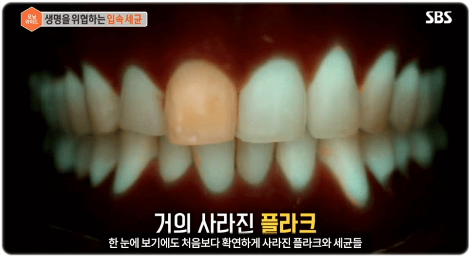 양치 후 가글