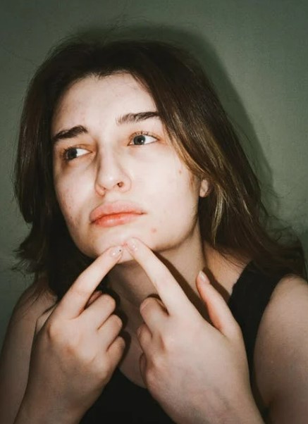 여드름 진정 화장품 제대로 고르는 법! 피부과 추천 성분부터 제품까지 총정리