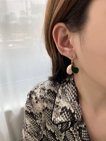 피부과 전문의가 알려주는 초록색 귀걸이 대처법에 대해_22