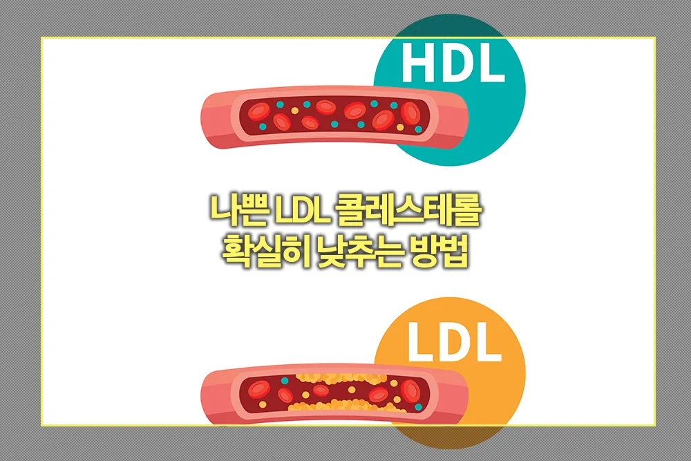 나쁜 LDL 콜레스테롤 확실히 낮추는 방법