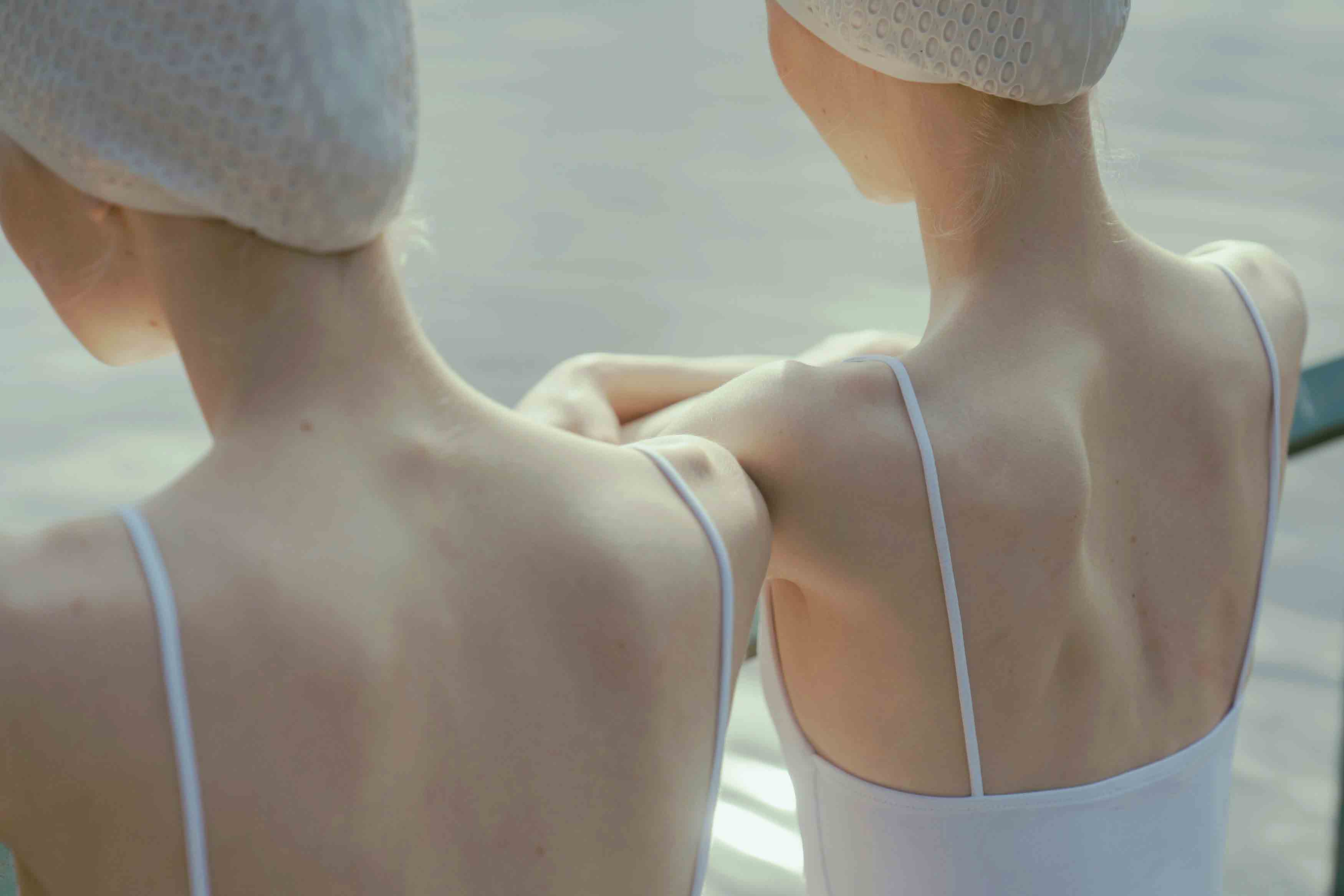 갑상선기능저하증 좋은음식 초기증상9