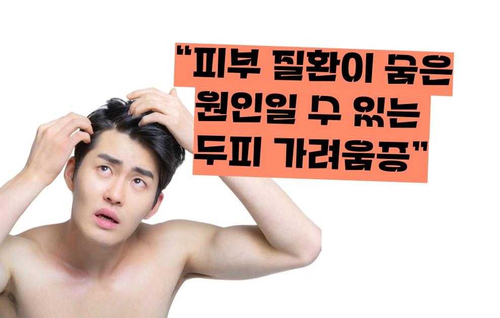 두피 가려움증 원인 치료