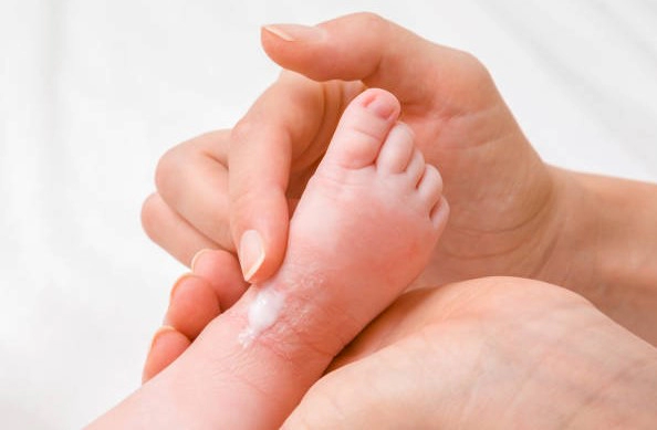 판테놀 연고 종류