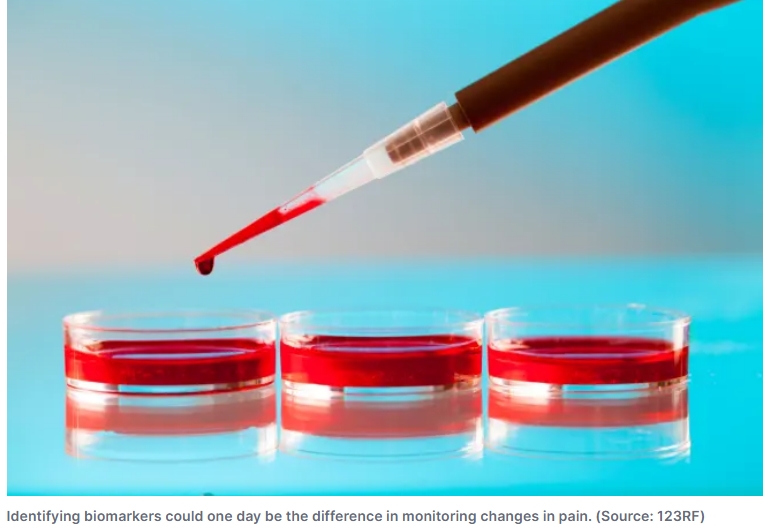 100세 이상 사는 사람들의 건강 요인 분석 People who live to 100 have these things in common, blood test shows