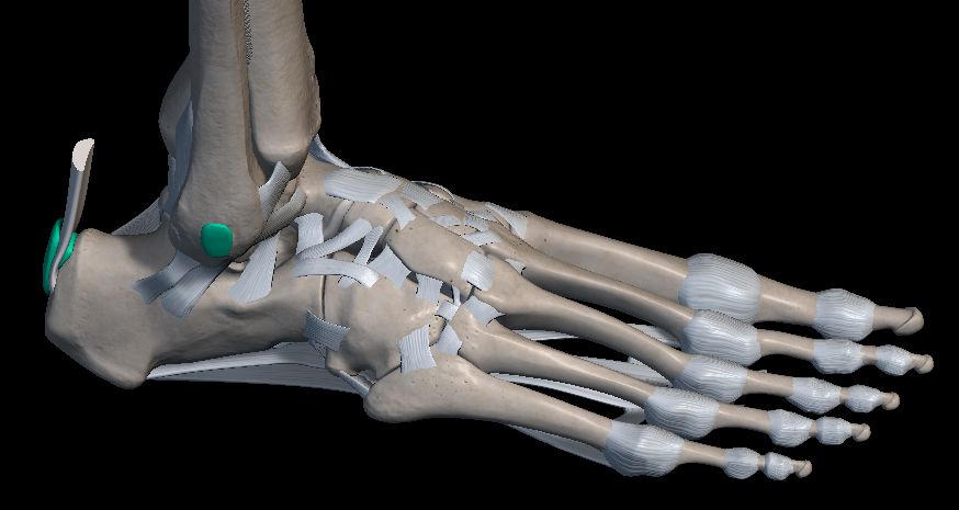 발목 안쪽 통증 원인 치료법