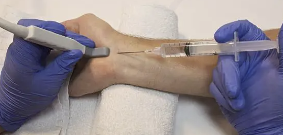 TDM(Therapeutic Drug Monitoring)용 LC-MS/MS 분석법의 표준화 과제