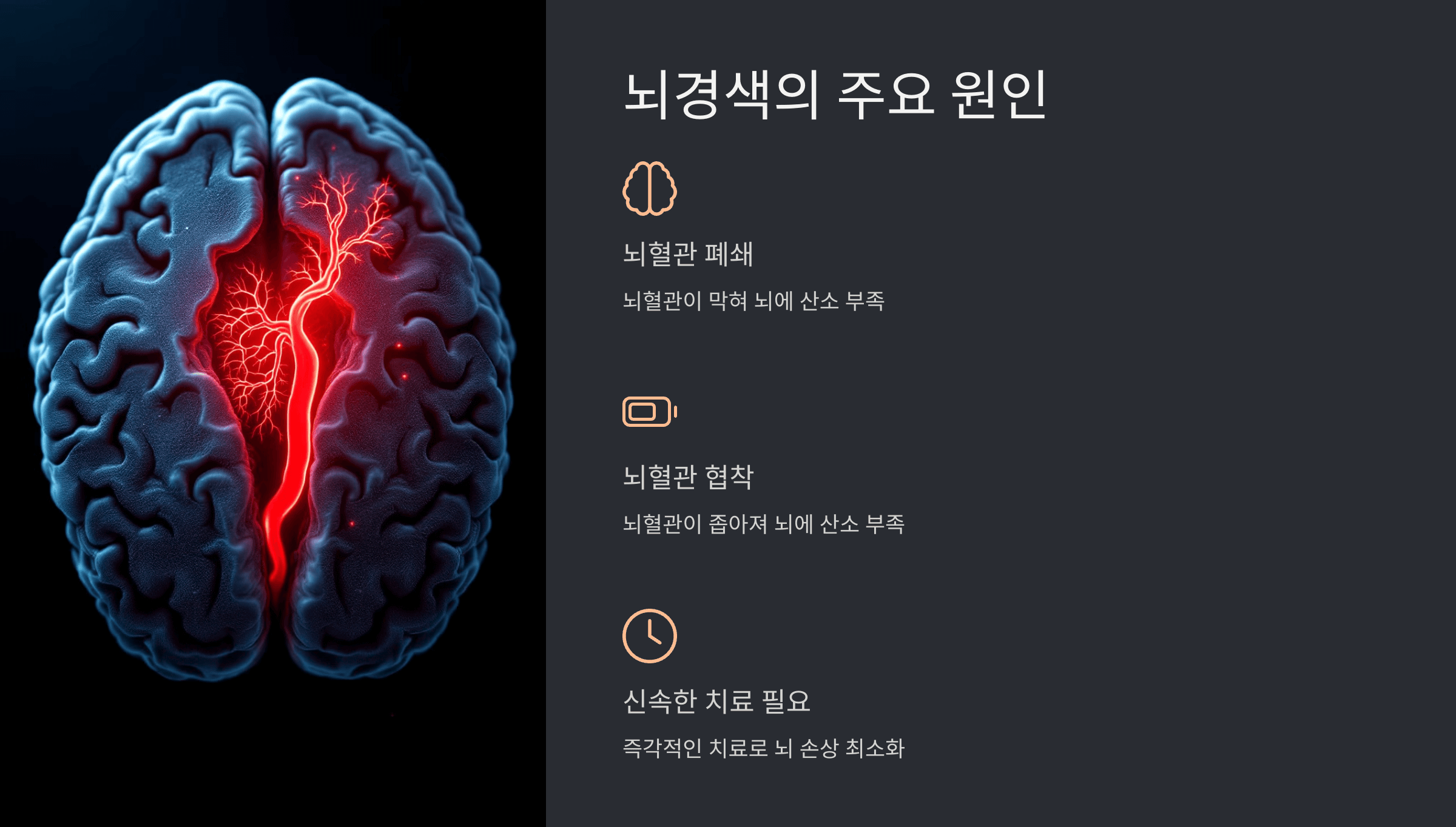 뇌경색과 관련된 사진입니다.