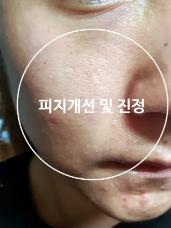 남자 얼굴 피지 제거 화장품 꿀템_24