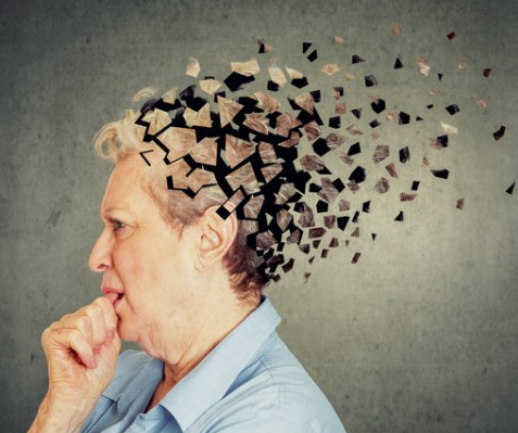 뇌영양제로 알려진 치매 치료제 글리아티린&amp;#44; 글리아타민은 사실 치매 예방약이 아니고&amp;#44; 오히려 뇌졸중을 유발한다고?