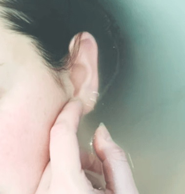 모공 줄이는 방법 - 각질 제거