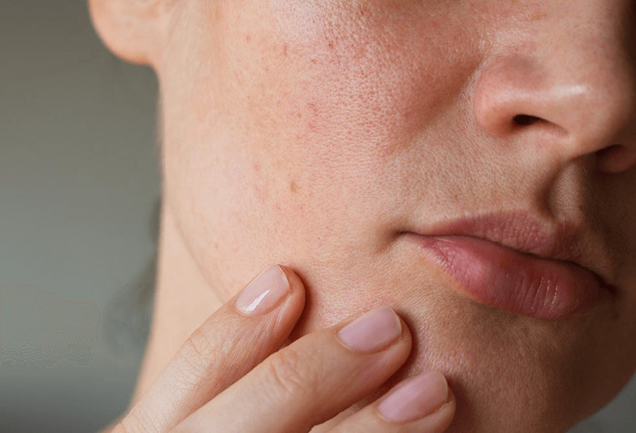 사람-얼굴-모공-모습