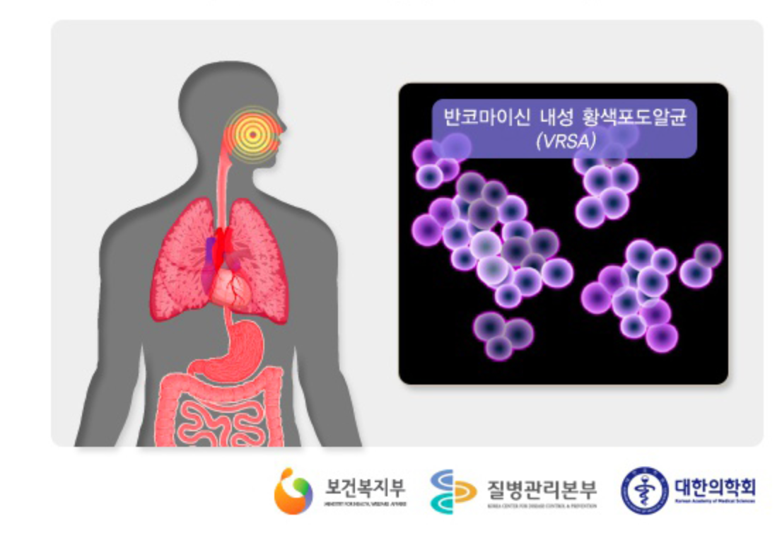 반코마이신 내성 황색포도알균