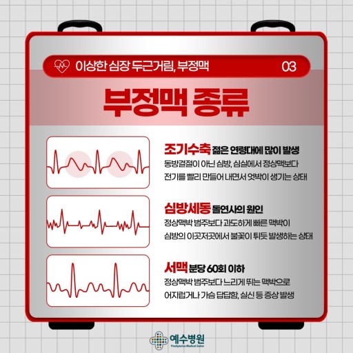 부정맥