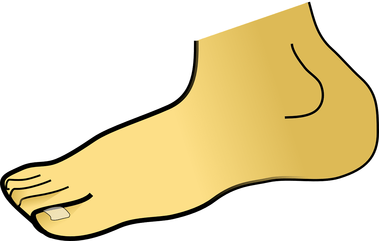 발뒤꿈치 갈라짐 각화증