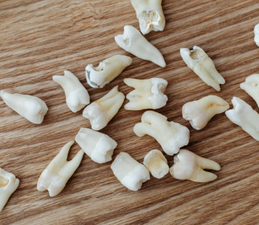 고양이 잇몸 부음 치은염 원인 증상 및 치료 후기