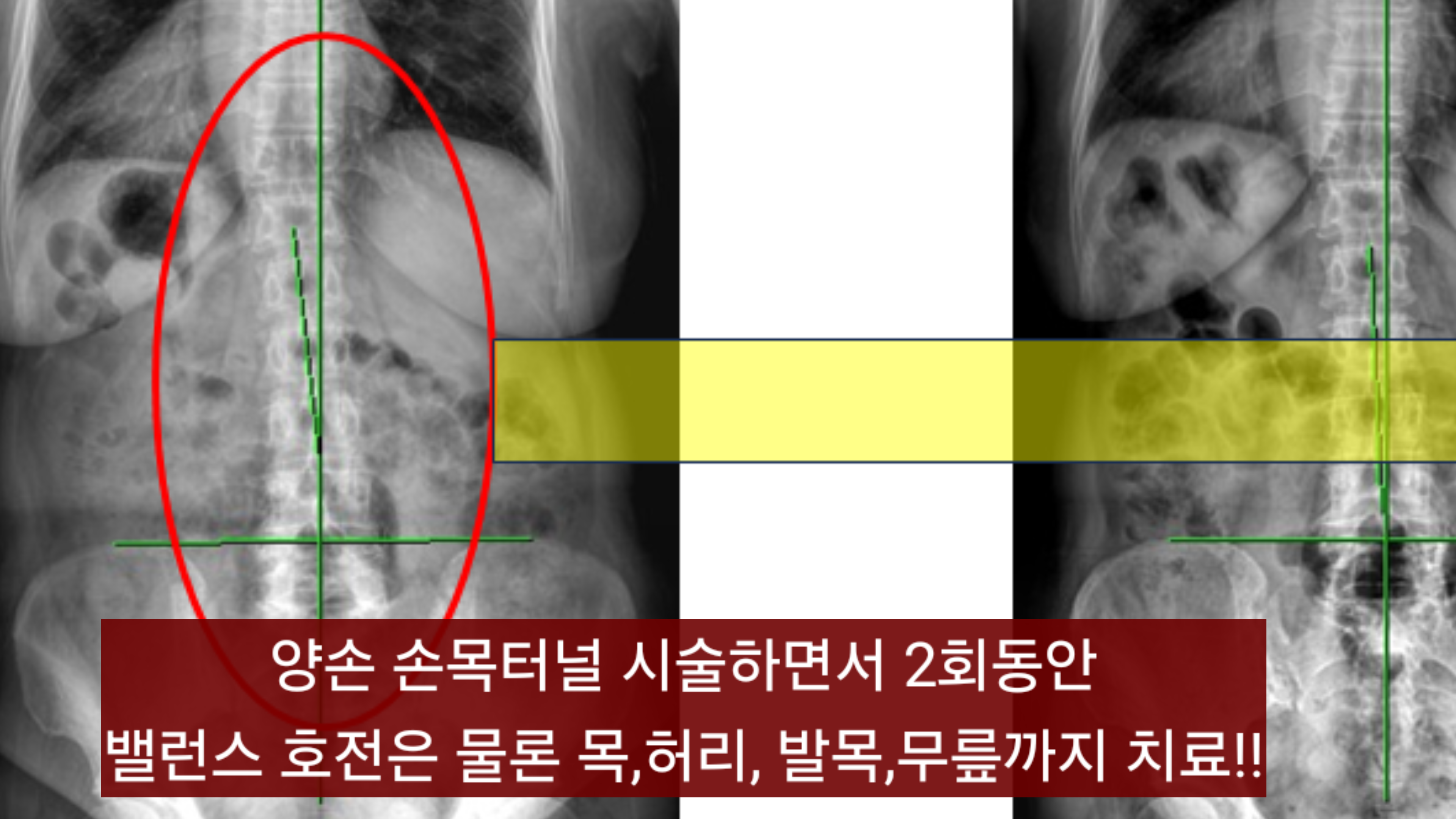 img.png?credential=yqXZFxpELC7KVnFOS48ylbz2pIh7yKj8&expires=1753973999&allow_ip=&allow_referer=&signature=j90dAsRXtS%2B4jarLYcAJ%2BRTPN6Q%3D