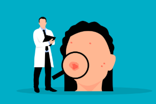 체리 혈관종 치료 방법