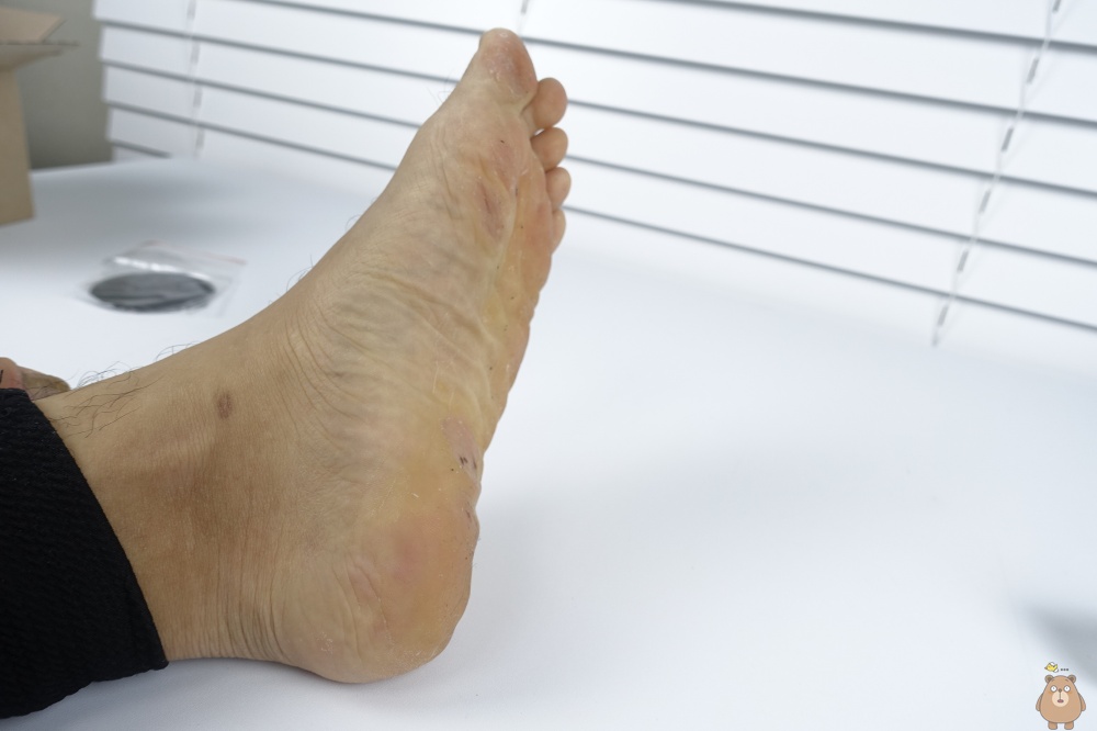 스크린 각질 제거기, 원형 사포 스타일