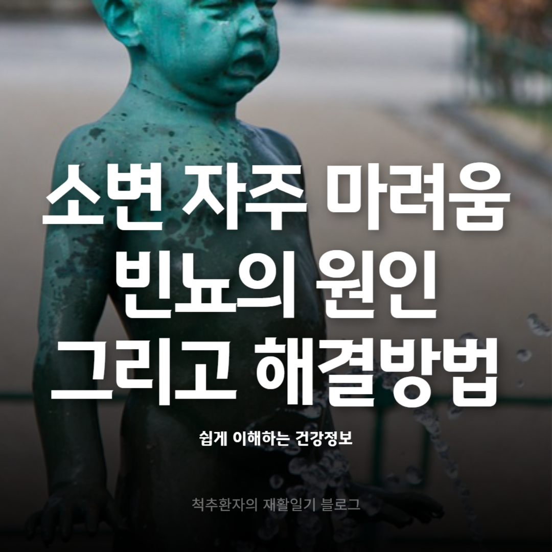 소변-자주-마려움-빈뇨