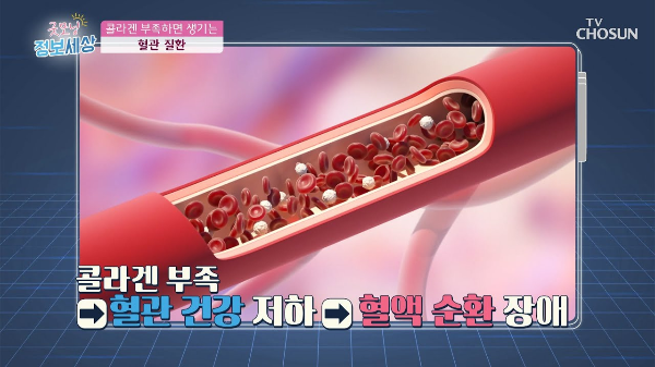 콜라겐-혈관-건강-동맥경화-하지정맥-심혈관질환-예방-효과