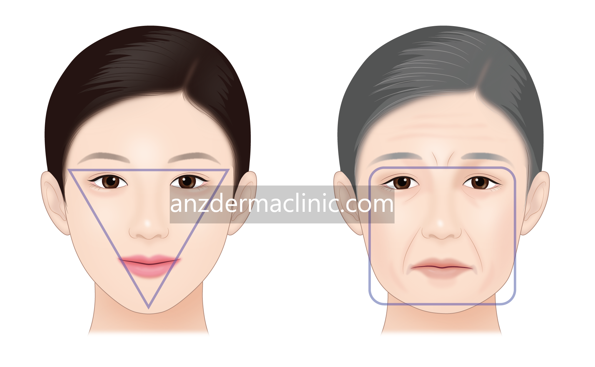 anzdermaclinic.com
anzdermaclinic.com