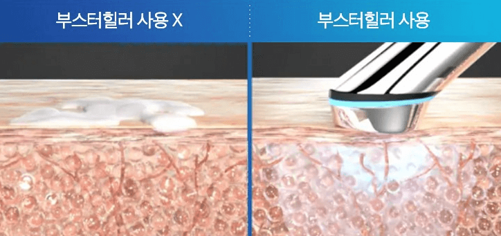 홈 뷰티 디바이스