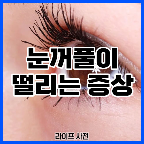 눈꺼풀이 떨리는 증상