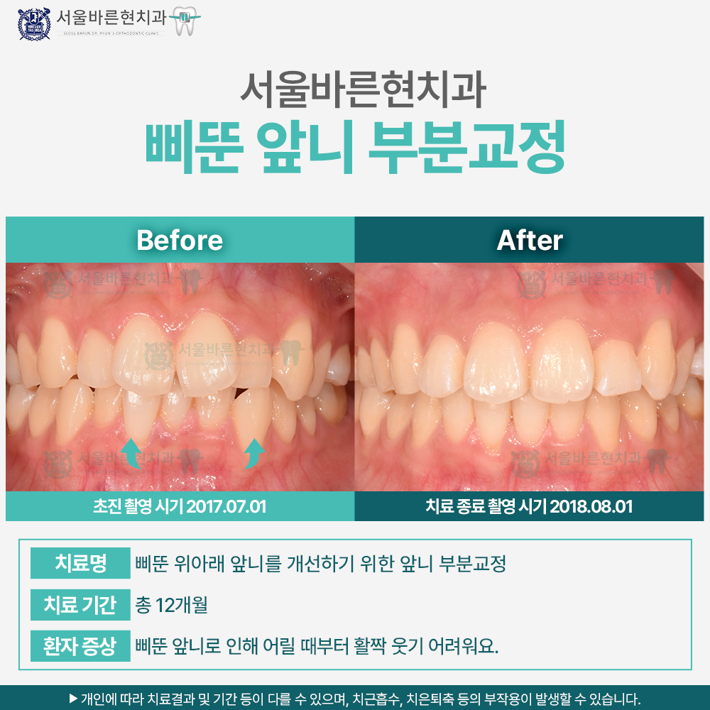해운대교정치과