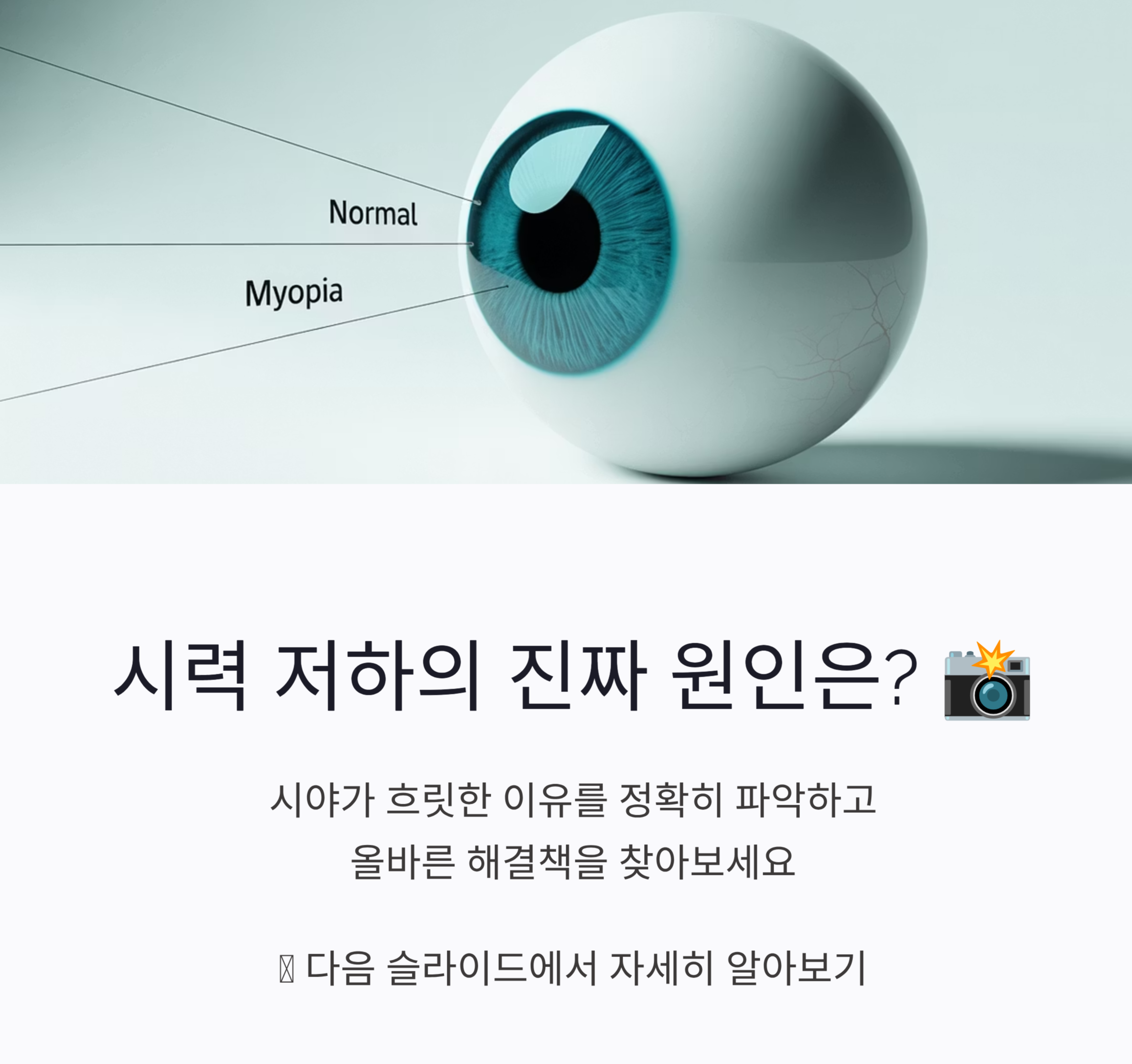 (노안,근시,난시)