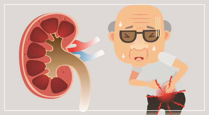 신장이 안좋으면 나타나는 증상